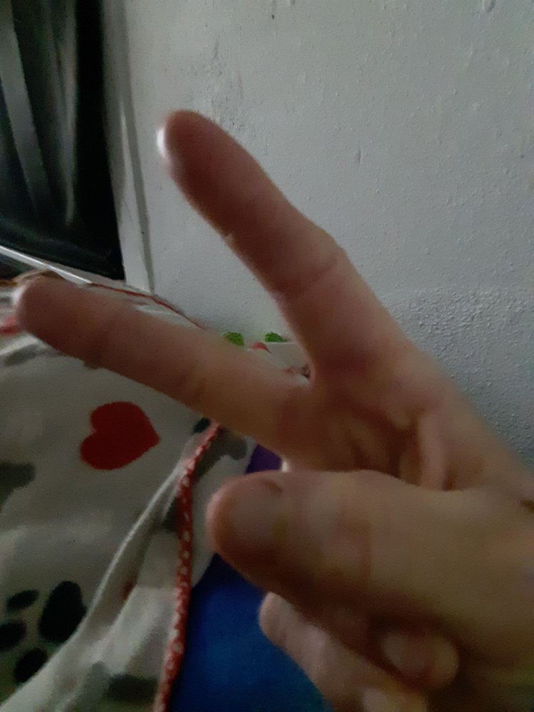 OAKLAND PHYSICAL THERAPY & HAND REHABILITATION Updated October 2024