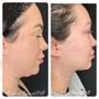 Photo of The Botox Bar and Aesthetics