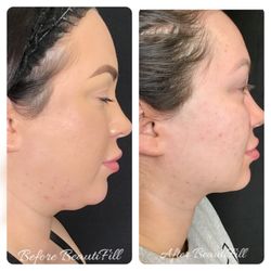 The Botox Bar and Aesthetics