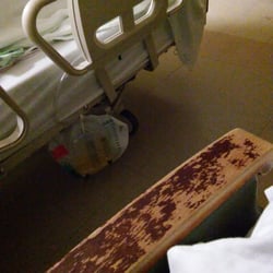 CHI St. Vincent Pulmonology & Sleep Medicine - Hot Springs - The catheter bag is tied on because the clip to hold it is broken off. The furnature is extremely worn.