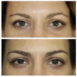 Before and after permanent stroke eyebrows.