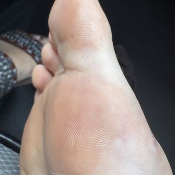 Luxy Nail Spa - Calluses when I left- not acceptable. - Nail Salons Near Me - Walnut Creek, California
