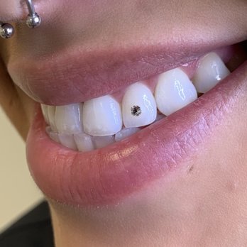 Bombshell Aesthetic - Clear Crystal Tooth Gem - Eyelash Service Near Me - Thousand Oaks, California