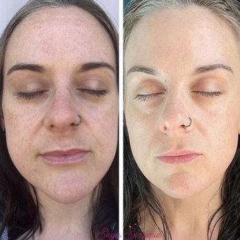 SKYN Spatique Esthetics - Skin Care Near Me SKYN Spatique Esthetics - Skin Care Near Me