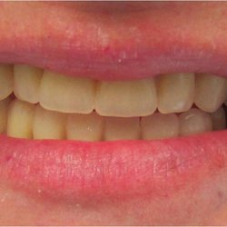Dental Aid 1 - Please guess is it am artificial or natural smile?