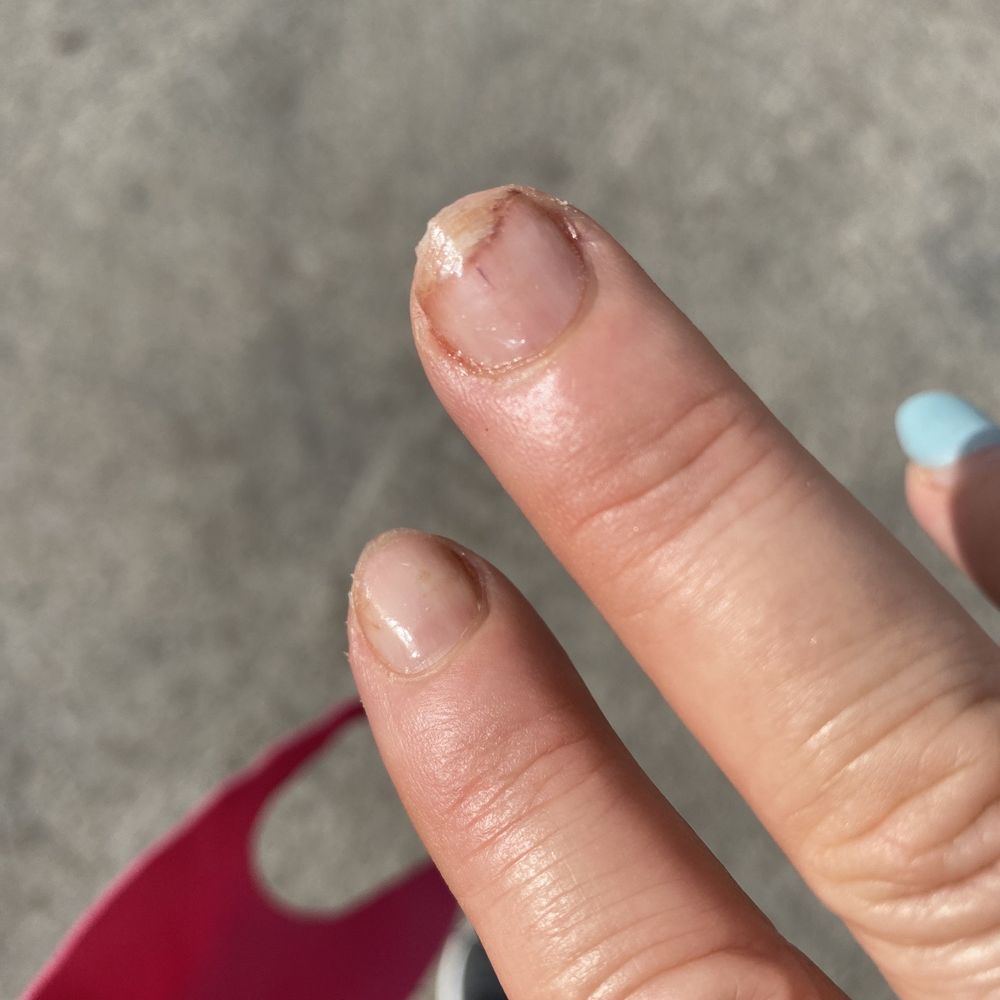 Cinderella Nails and Spa - They damaged my nails horribly. Do not go to this place - Nail Salons Near Me - Houston, Texas