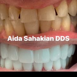 Aida Sahakian, DDS - Full mouth zirconium crowns