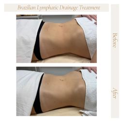 Madam Body - Lymphatic Drainage