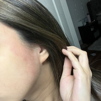 CNN Hair Team Salon - Irritation from toner - Hair Salons Near Me - Austin, Texas CNN Hair Team Salon - Irritation from toner - Hair Salons Near Me - Austin, Texas