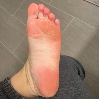 Floris Nail & Spa - This is the bottom of my foot AFTER the pedicure. Ridiculous - Day Spas Near Me - West New York, New Jersey