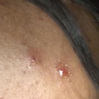 Massage Envy - Same day of facial, when I was told "your skin looks great" - Massage Near Me - Mansfield, Texas Massage Envy - Same day of facial, when I was told "your skin looks great" - Massage Near Me - Mansfield, Texas
