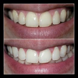 Before & After Before & After