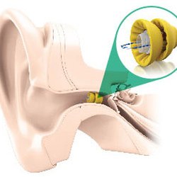 Better Hearing Center - Better Hearing Center of Palo Alto is a Lyric Premier Elite Provider