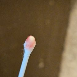 Ramin Assili, DDS - Blood from the area