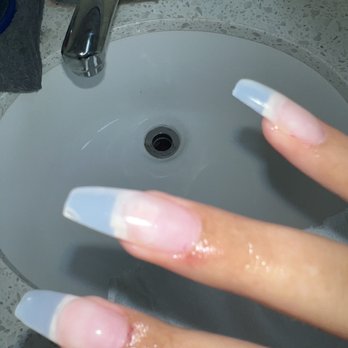 Only Nails - Multiple lesions from drill - Nail Salons Near Me - District Heights, Maryland