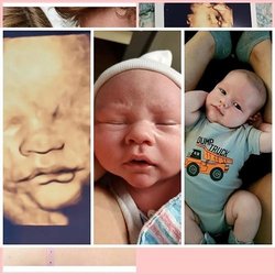 Chubby Cheeks 3D/4D Ultrasound Studio of High Point & Greensboro