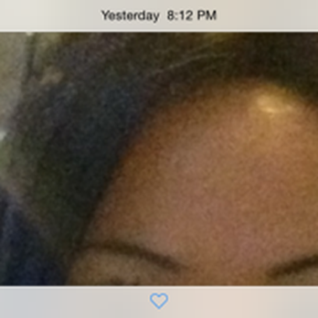 Electrolysis by Janet - my brows before janet completely ruined them - Hair Removal Near Me - Glendale, California Electrolysis by Janet - my brows before janet completely ruined them - Hair Removal Near Me - Glendale, California