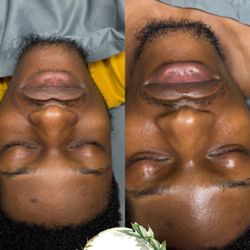 Uptown Beauty Salon - Facials before and after by Mya!!