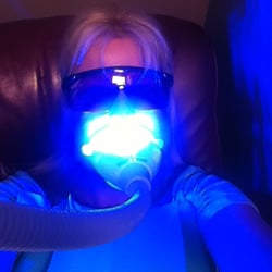 Elite Smile - This is what a teeth whitening session looks like.