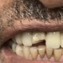 Photo of Gums Dental Care