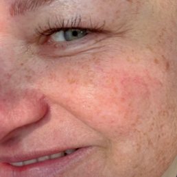 microblading