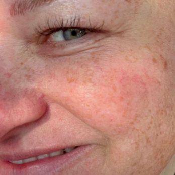 Beautopia Skin Studio - microblading - Medical Spas Near Me - Houston, Texas