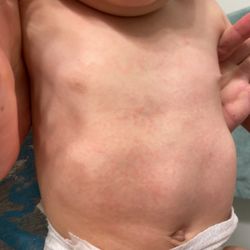 Charleston ENT & Allergy