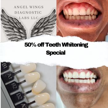 Angel Wings - Teeth Whitening Special - Laboratory Testing Near Me - Plantation, Florida Angel Wings - Teeth Whitening Special - Laboratory Testing Near Me - Plantation, Florida
