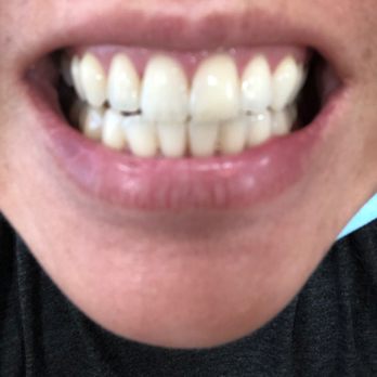 4Ever Beauty by Leiloni - Teeth whitening! - Permanent Makeup Near Me - Sacramento, California 4Ever Beauty by Leiloni - Teeth whitening! - Permanent Makeup Near Me - Sacramento, California