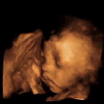 Peek A Boo - Ultrasound Imaging Centers Near Me - Hesperia, California
