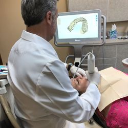 Art of the Smile - No putty impressions - digital scans are easy and more accurate!