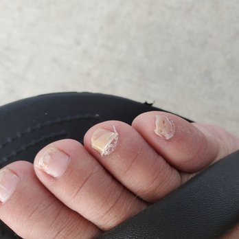 Rio Nail Bar & Lash - My toenail falling off after realizing that I contracted a fungus. I've always kept up with my feet. Never has this happened before. - Eyelash Service Near Me - Schertz, Texas