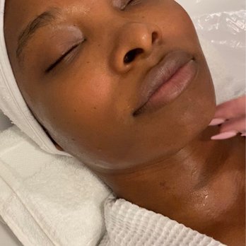 Contourology - Immediately after face endospheres treatment! - Body Contouring Near Me - Los Angeles, California