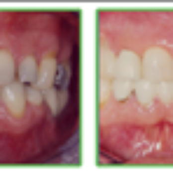 Sam English, DDS - General Dentistry Near Me - Mechanicsville, Virginia Sam English, DDS - General Dentistry Near Me - Mechanicsville, Virginia