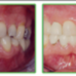 Sam English, DDS