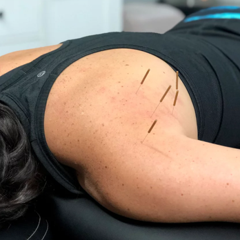 Allain Physical Therapy - Dry needling offered - Physical Therapy Near Me - Bedford, New Hampshire