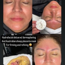 Facial treatment