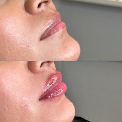 Envy Injectables & Skincare