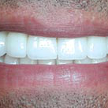 Peter Yu, DDS - General Dentistry Near Me - Milpitas, California Peter Yu, DDS - General Dentistry Near Me - Milpitas, California