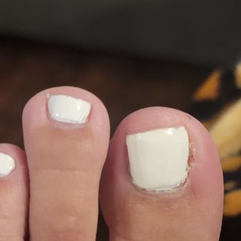 Rose Couture Nail Bar- Prosper - Messy nail polish and my toenails are not straight. I also got a cut on my toe. - Nail Salons Near Me - Prosper, Texas Rose Couture Nail Bar- Prosper - Messy nail polish and my toenails are not straight. I also got a cut on my toe. - Nail Salons Near Me - Prosper, Texas