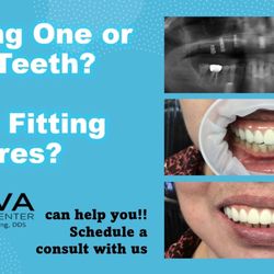 NOVA Dental Center - Dental implants