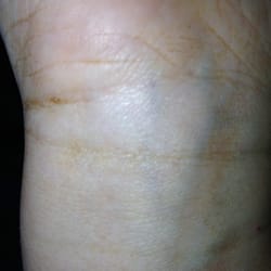 Touch Face and Body Studio - My wrist, orange and splotchy, 5 days after my tan.