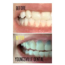 Youngsville Dental Care - Youngsville Dental
