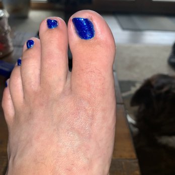 CnL Nails - Big toe ripped off in right corner - Nail Salons Near Me - Woodland Park, Colorado