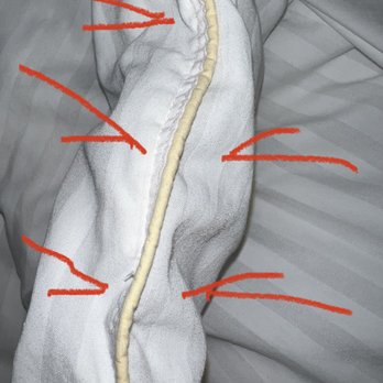 SpringHill Suites by Marriott Huntington Beach Orange County - Discolored comforter piping - Hotels Near Me - Huntington Beach, California SpringHill Suites by Marriott Huntington Beach Orange County - Discolored comforter piping - Hotels Near Me - Huntington Beach, California