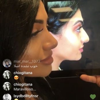 Ramtin Kassir, MD - Cosmetic Surgeons Near Me - Ridgewood, New Jersey Ramtin Kassir, MD - Cosmetic Surgeons Near Me - Ridgewood, New Jersey