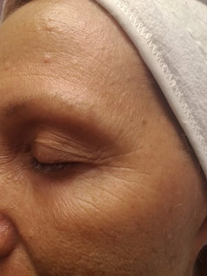 The Center For Paramedical Esthetics Skin Care 371 N Royal Poinciana Blvd Miami Springs Fl Phone Number Services Closed Yelp