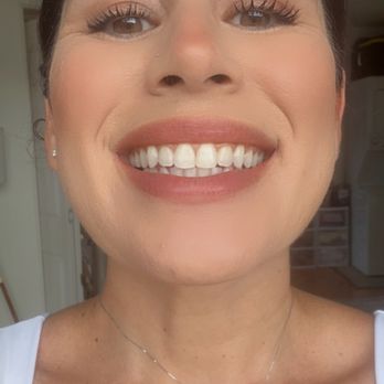 Katherine M Masaki, DDS, MS - After - Orthodontists Near Me - Honolulu, Hawaii
