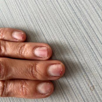 Cayuga Nail Spa - Various stages of my nails showing the split down the middle of some. - Nail Salons Near Me - Ithaca, New York