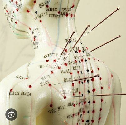 Acupuncture appointments now available~ - Acupuncture involves the insertion of very thin needles through your skin at strategic points on your body. A key component of traditional Chinese medicine, acupuncture is most commonly used to treat pain. Increasingly, it is being used for overall wellness, including stress management. Acupuncture appointments now available~ - Acupuncture involves the insertion of very thin needles through your skin at strategic points on your body. A key component of traditional Chinese medicine, acupuncture is most commonly used to treat pain. Increasingly, it is being used for overall wellness, including stress management.